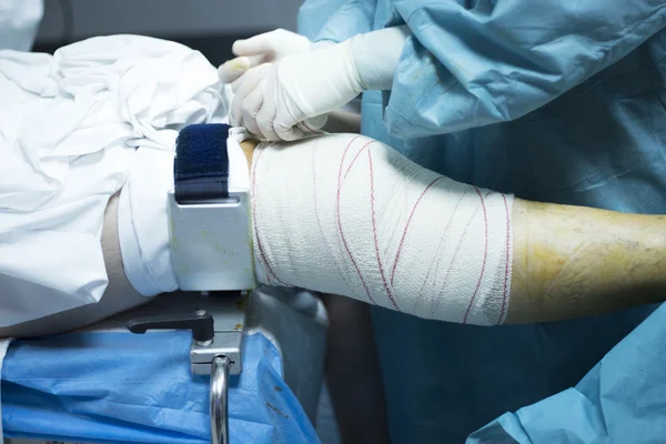 Knee arthroscopy orthopedic surgery operation