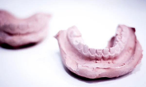 Dental prosthetics clay tooth mold