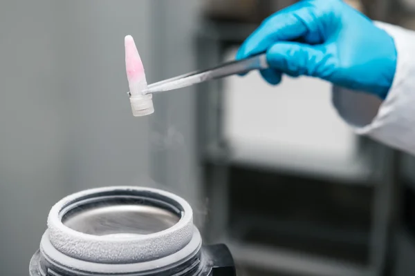 Scientist holding container with suspension of stem cells for cryopreservation.