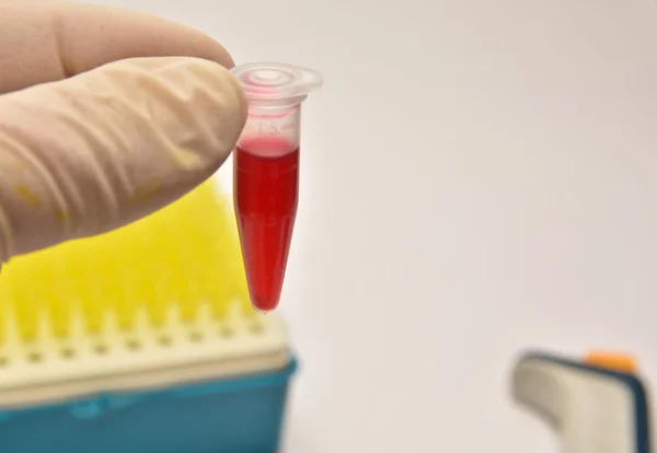 Blood testing in clinical diagnostic laboratories.