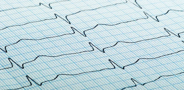 Cardiogram of heart beat