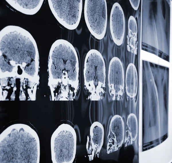 Unusual view of the MRI, X-ray images of the patient