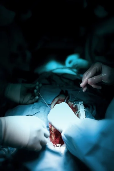 Job surgeons during open-heart surgery