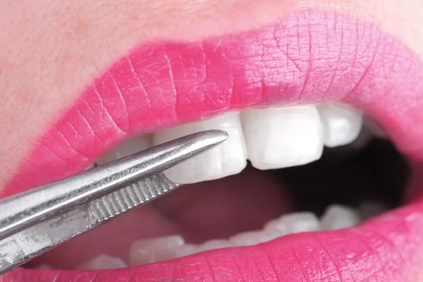 Female mouth examined by a doctor with forceps