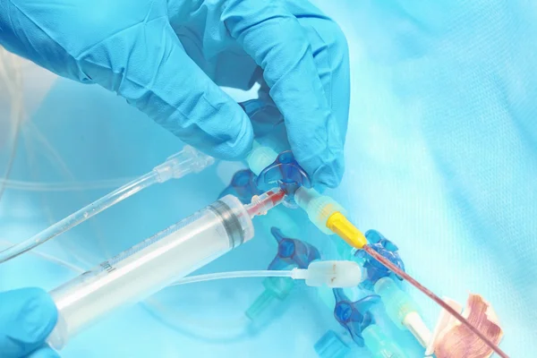 Catheter injection of the medical staff
