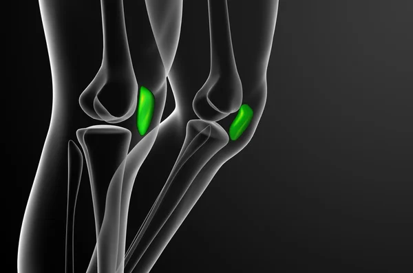 3d render medical illustration of the patella bone