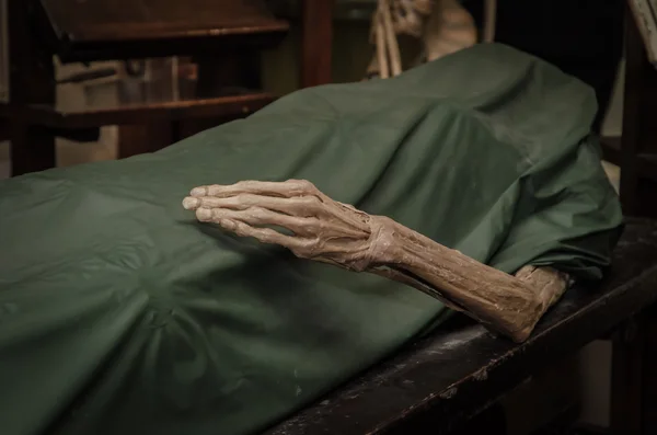 The dead body. Focus on hand decay.