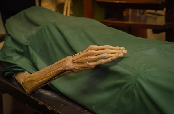 The dead body. Focus on hand decay