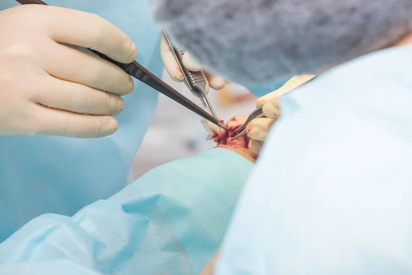 Surgery to change the shape of the nose