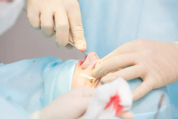 Surgery to change the shape of the nose