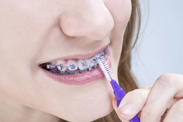Dental Hygiene Concepts. Closeup Shot of Caucasian Teenage Girl