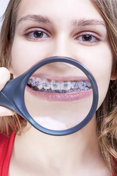 Dental Health and Hygiene Concepts. Caucasian Female Demonstrating Her Teeth with Brackets Through Magnifying Glass
