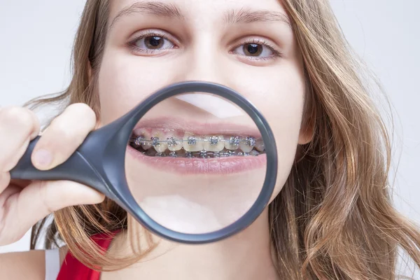 Dental Health and Hygiene Concepts. Caucasian Female Demonstrating Her Teeth with Brackets Through Magnifying Glass.