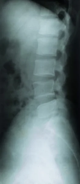 X-rays of human neck bone