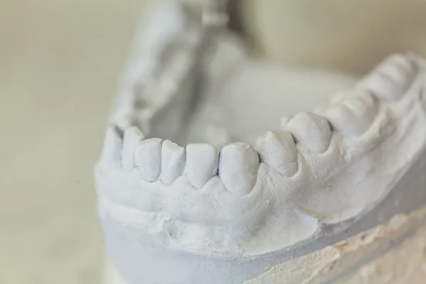 Dental Molds of Human Teeth