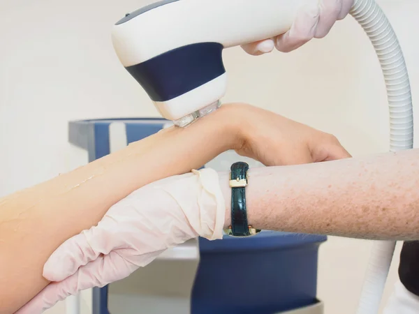 Laser hair arm removal epilation. Treatment in cosmetic salon.