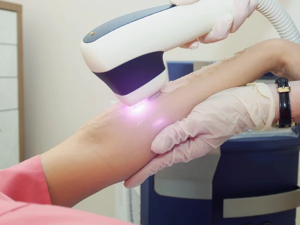 Laser hair arm removal epilation. Treatment in cosmetic salon.