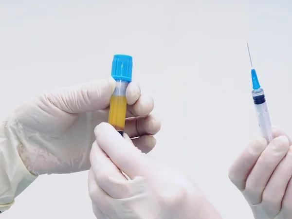 Hands holding separated blood and syringe in test tube at  laboratory