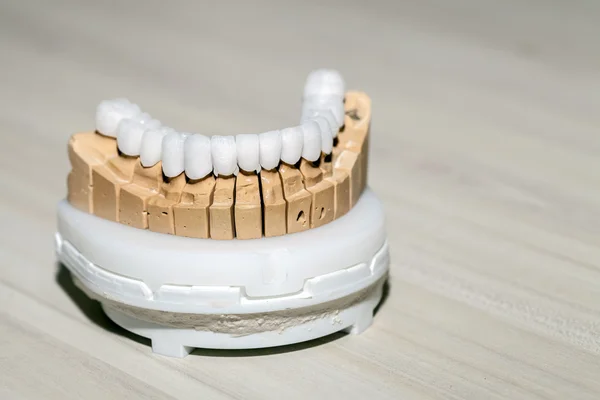 Zirconium Porcelain Tooth plate in Dentist Store