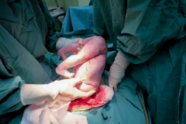 Cesarean pregnancy mother in operation room giving birth baby wrong position out from bottom