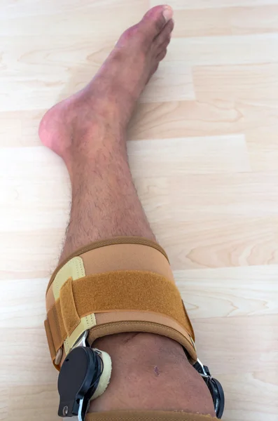 Knee brace support for leg or knee injury