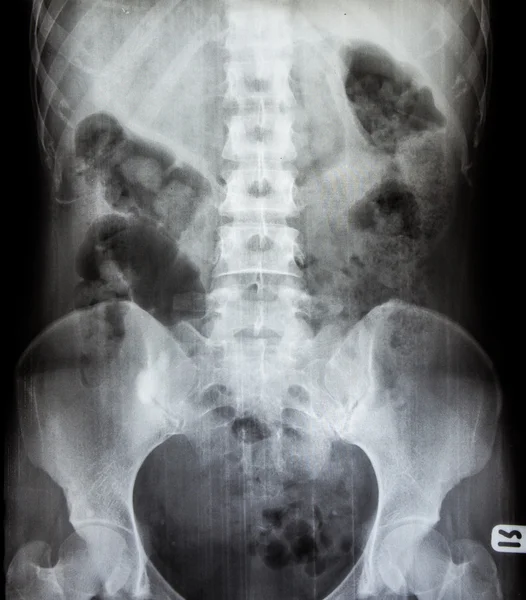 X-Ray scan human