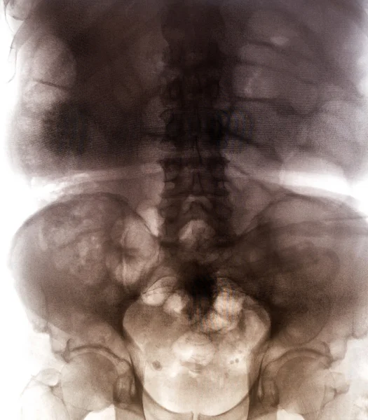 X-Ray scan of human bones