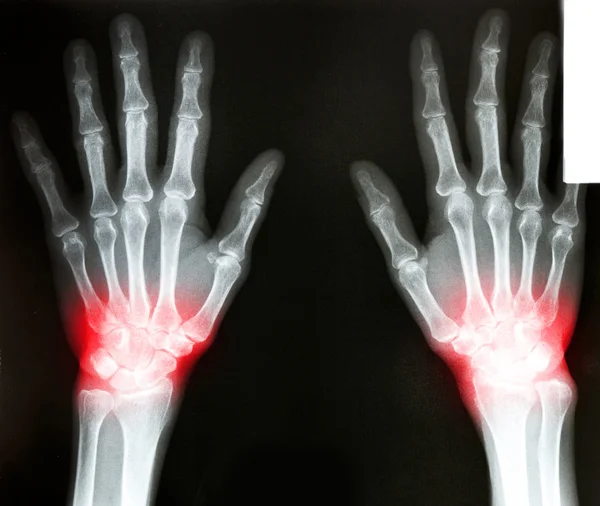 Film X-Ray scan human