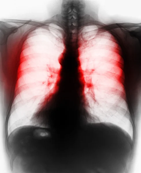 X-ray of human bones