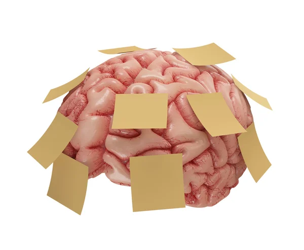 Human brain with yellow sticky notes attached