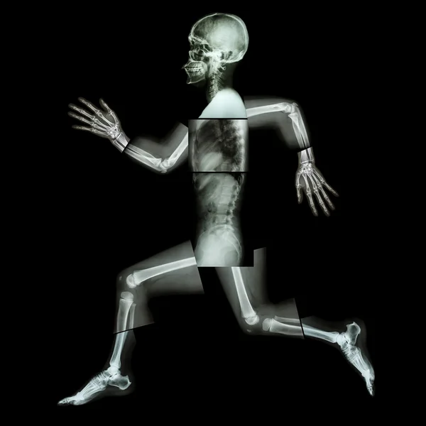 Aerobic Exercise (human bone is running) ,(Whole body x-ray : head ,neck ,shoulder ,shoulder ,arm ,elbow ,forearm ,hand ,finger ,joint ,thorax ,abdomen ,back,pelvis ,hip ,thigh ,leg ,knee ,foot ,heel)