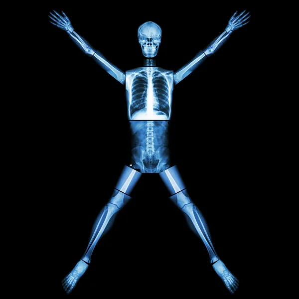 Human bone is stretching arm and leg (whole body : head neck spine back abdomen chest shoulder arm elbow forearm hand wrist lung heart pelvis hip thigh leg knee ankle foot finger heel )