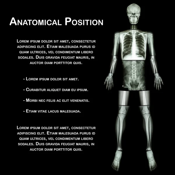 Anatomical Position. (X-ray whole body : head ,neck ,thorax ,heart ,lung ,rib ,shoulder ,scapula ,arm ,forearm ,elbow ,wrist ,hand ,digit ,abdomen ,hip ,pelvic ,leg ,thigh ,knee ,ankle ,heel ,foot )