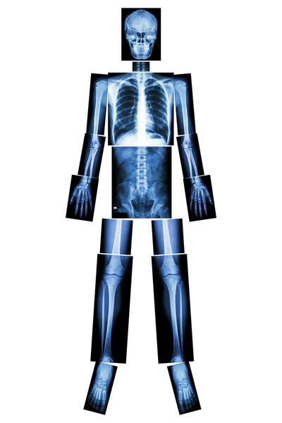 Anatomical Position. (X-ray whole body : head ,neck ,thorax ,heart ,lung ,rib ,shoulder ,scapula ,arm ,forearm ,elbow ,wrist ,hand ,digit ,abdomen ,hip ,pelvic ,leg ,thigh ,knee ,ankle ,heel ,foot )