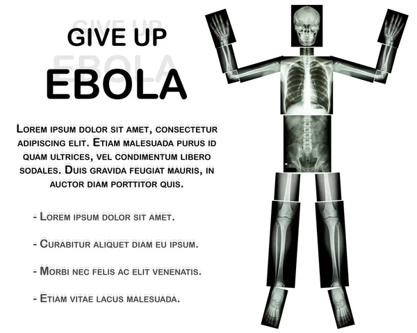 Give Up EBOLA. (Human bone raise the hand) (Whole body : head neck spine shoulder arm elbow forearm wrist hand finger thorax heart lung back abdomen pelvis hip thigh leg knee foot ankle heel)