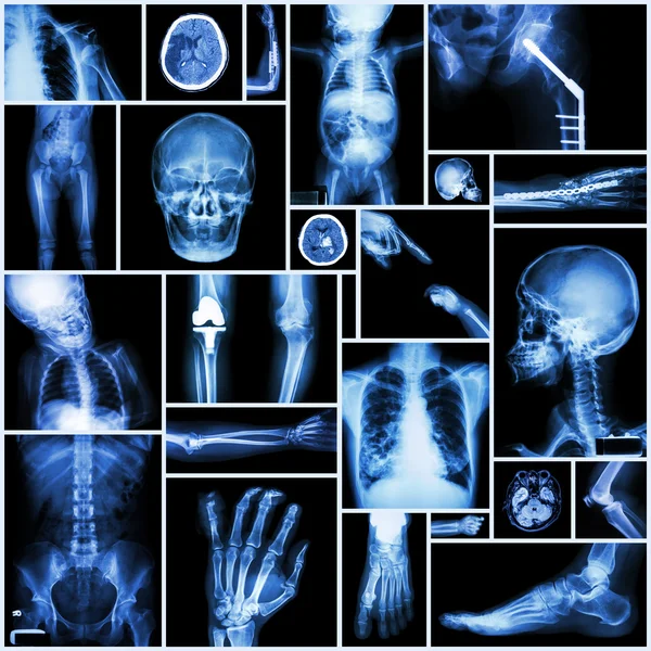 Collection X-ray 