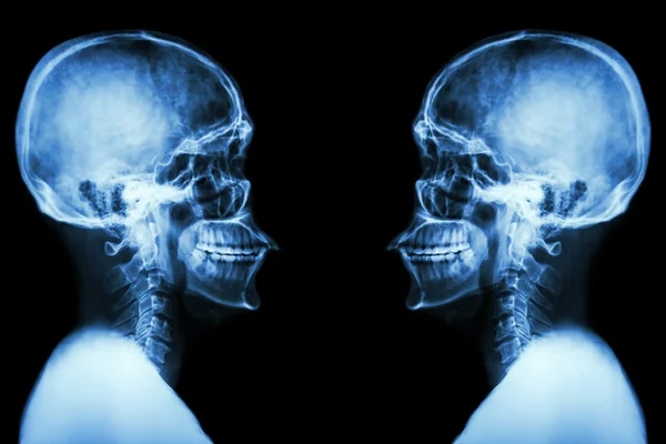 X-ray Skull and cervical spine