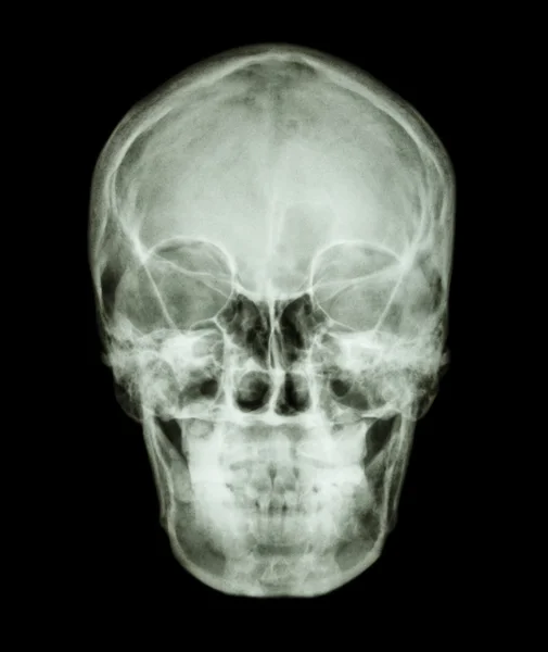 Normal asian human\'s skull (Thai people)