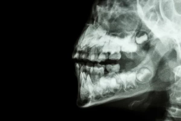 Human\'s jaw and teeth