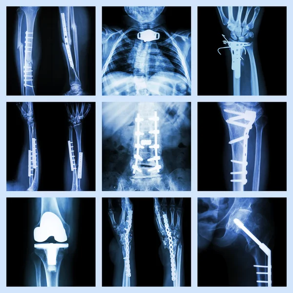 Collection of orthopedic operation