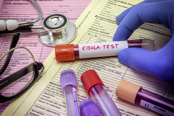 Tests For Research Of Ebola virus Doctor holding a vial of vaccine virus Ebola