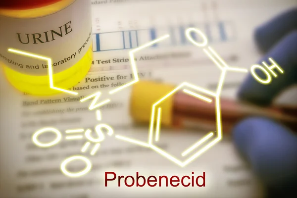 Tests for Research of urine, Probenecid is able to inhibit compl