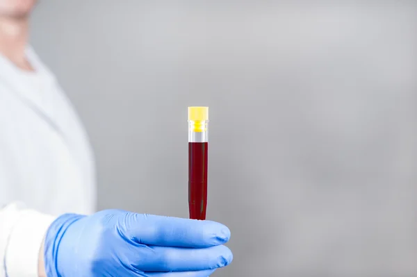 Test tube with blood, test tube with fluid,