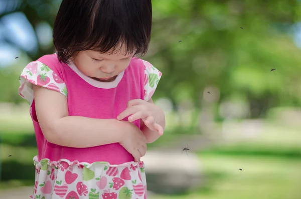 Girl has allergies with mosquitoes bite