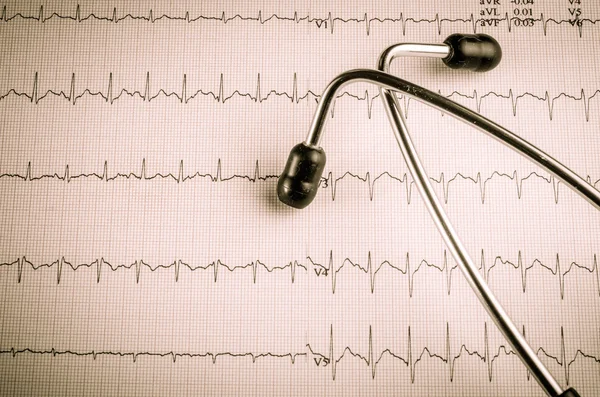 Medical examination, electrocardiogram, heart medicine and thera