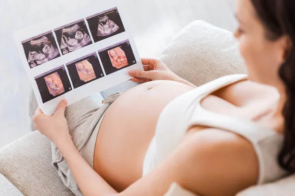 Pregnant woman holding x-ray image