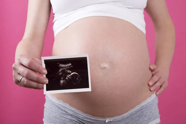 Closeup of a pregnant woman with an ultrasound picture in her ha