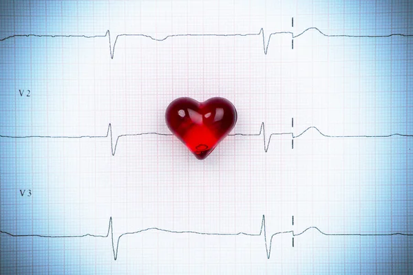 EKG heart diagram