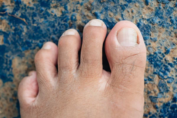 Male foot and toes on steel floor background