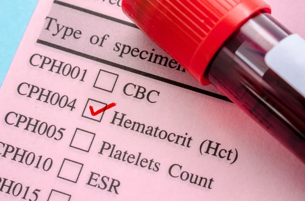 Hematocrit test blood.